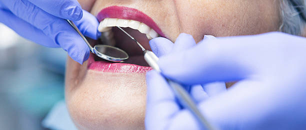 Teeth Whitening in NC